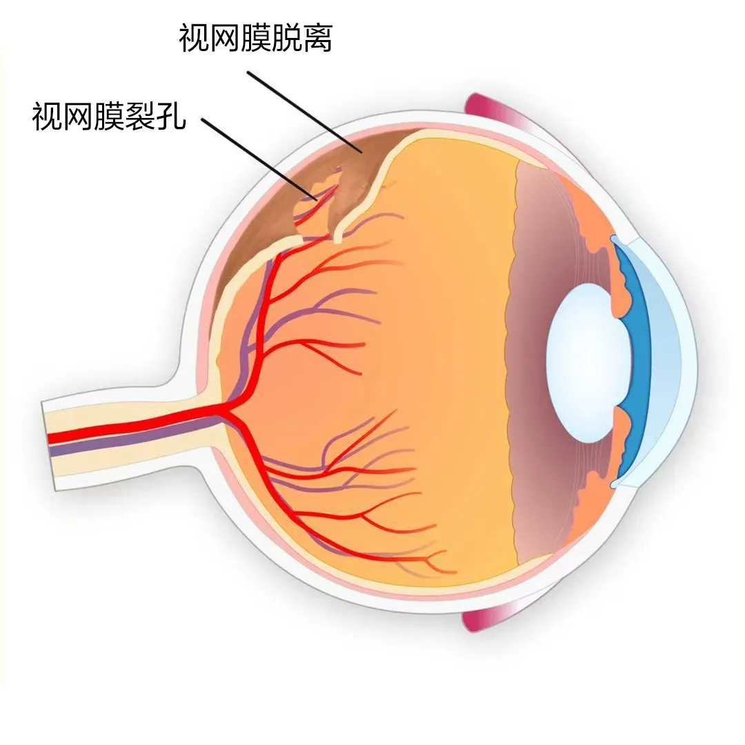 Patient receiving a comprehensive dilated retinal examination at Shanghai HePing Eye Hospital