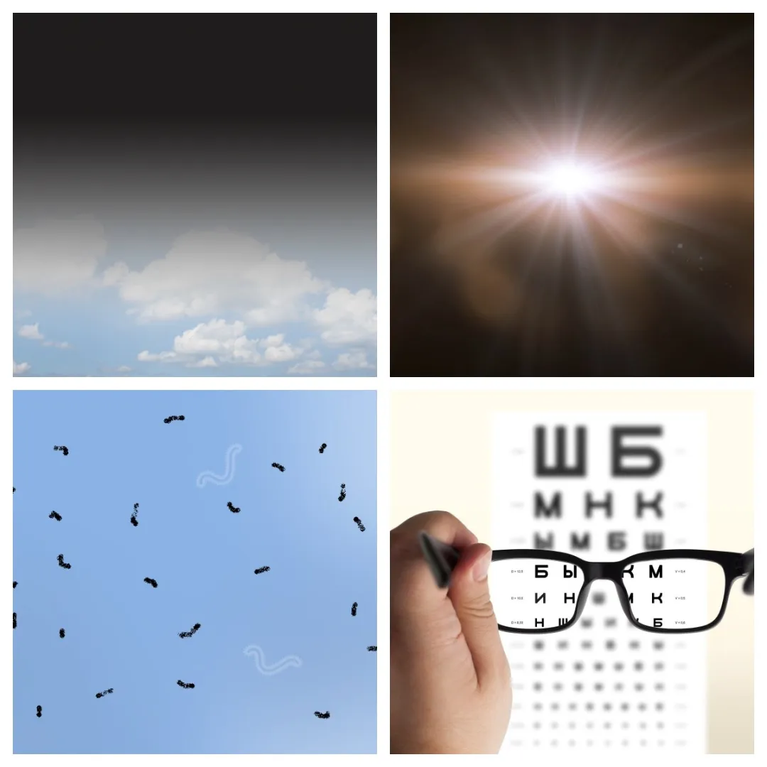 Camera film analogy showing how the retina captures images like photographic film